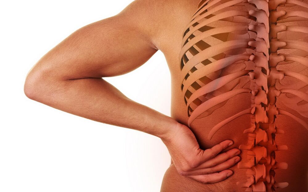 osteoxondroz tufayli bel og'rig'i