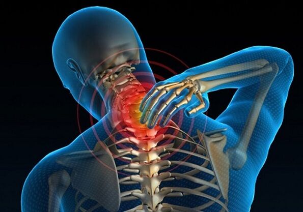 osteochondroz tufayli bo'yin og'rig'i
