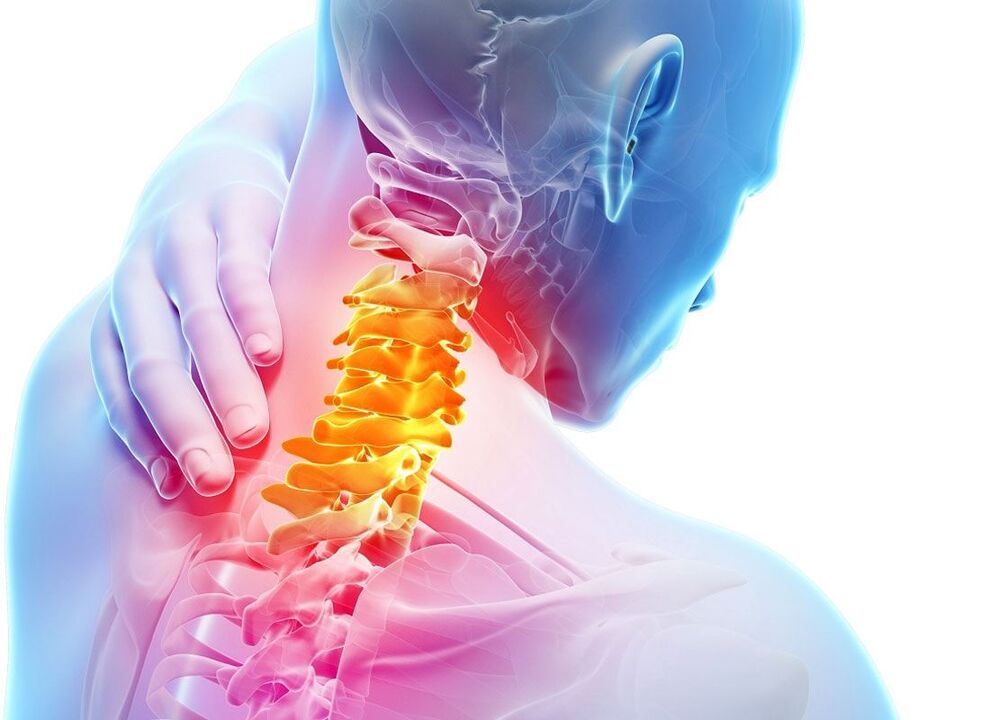 osteoxondrozning lokalizatsiyasi
